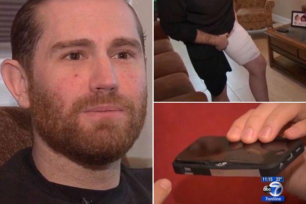 Pria Ini Terluka Parah Setelah iPhone Plastik Meledak di Saku Celananya